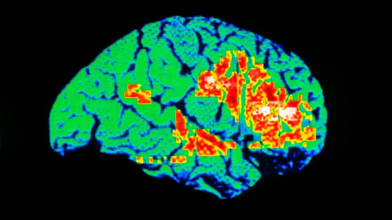A Boy Rubbed 1 Tube Pain Relief Cream Between His Legs. This Is What Happened To His Brain.