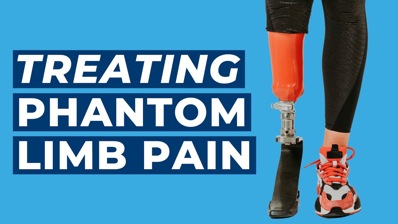 What is Targeted Muscle Reinnervation? | Treating Phantom Limb Pain