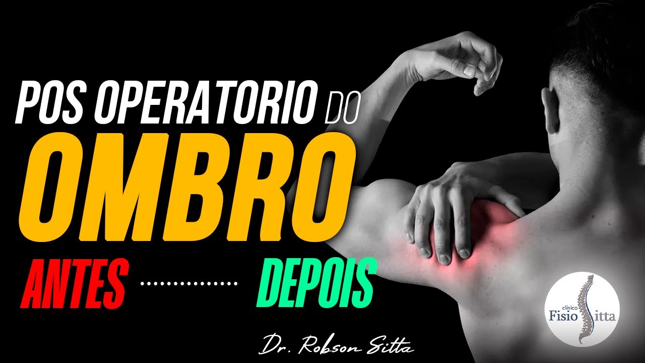 PÓS OPERATÓRIO CIRURGIA MANGUITO ROTADOR SUPRAESPINHAL - Clínica de Fisioterapia Dr. Robson Sitta