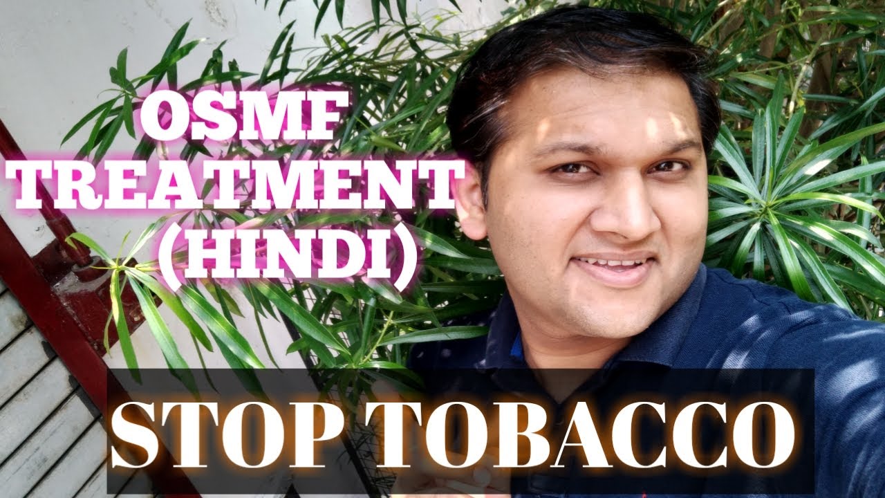 OSMF TREATMENT//How can I improve my mouth opening?//HOME REMEDIES//MOUTH EXERCISE//DRUGS TREATMENT