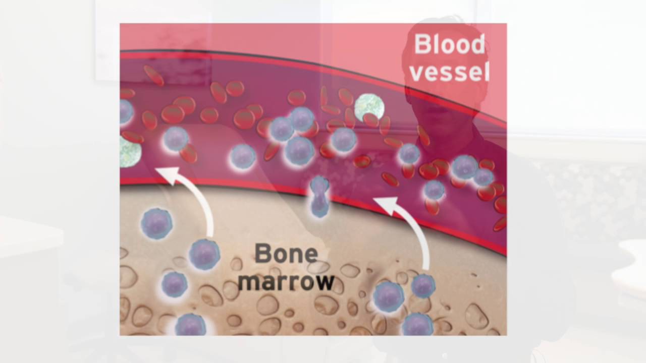 Stem Cell Pre-Collection and Mobilization