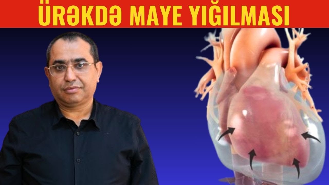 İNFEKSİYANIN səbəb olduğu xəstəlik \ Ürəkdə MAYE YIĞILMASI