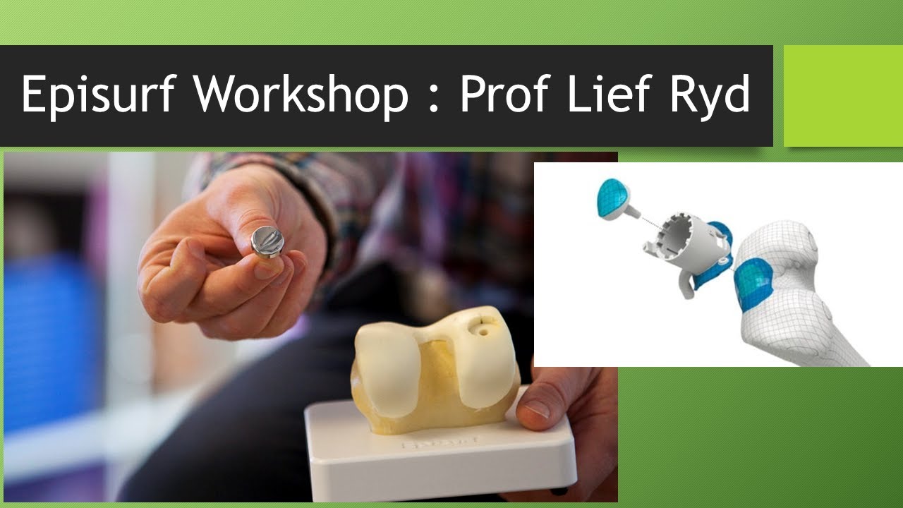 Episurf workshop :3 D Trochlear Replacement ;  Advance hospitals Ahmedabad
