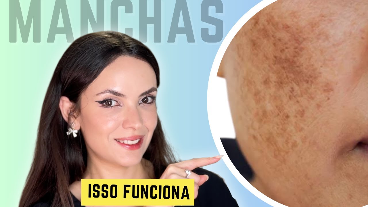 Como Clarear Manchas EM CASA, Cientista Explica