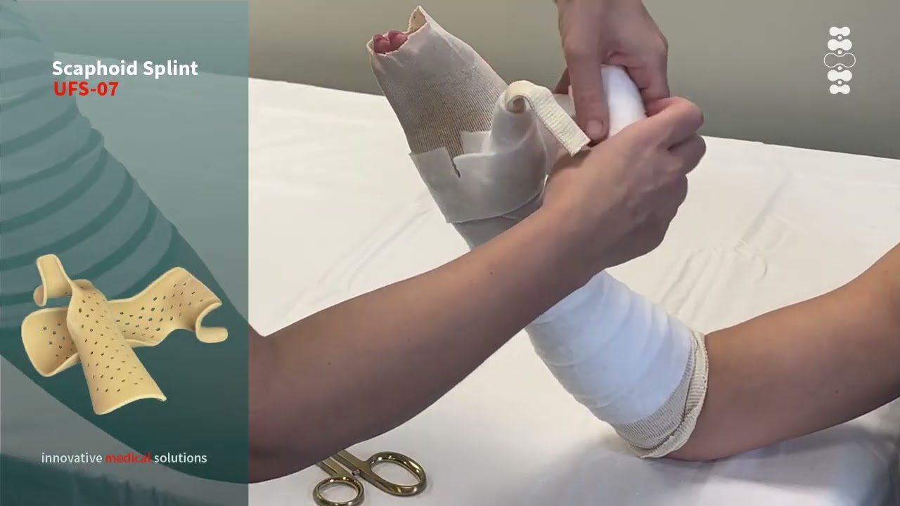 GeniMedical Scaphoid Spalk UFS 07