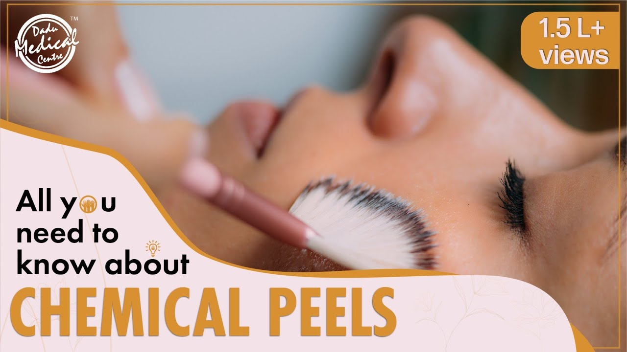 How to Choose the Right Chemical Peels for Your Skin? | Chemical Peel Treatments on Face (In Hindi)
