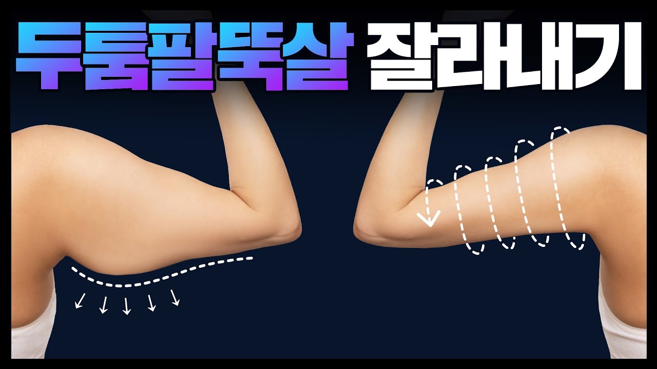 스트레스 받던 '위팔뚝살' 완전 소멸시키는 10분 루틴❤‍🔥💪🏻