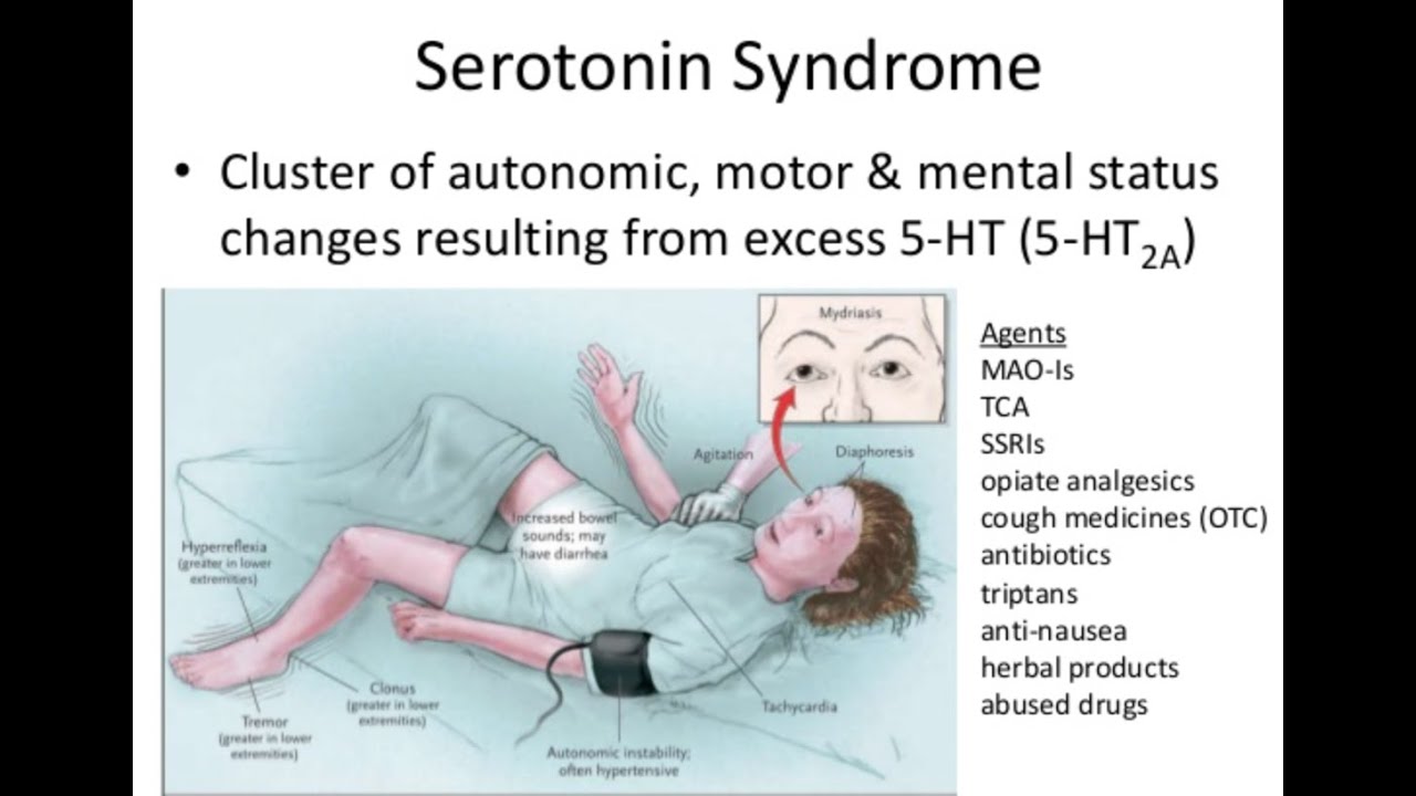 Serotonin Syndrome