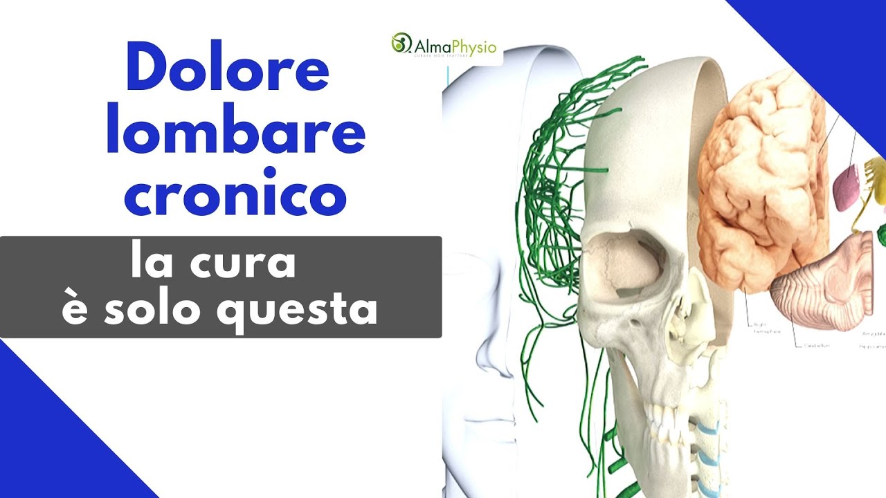Dolore lombare cronico: la cura è solo questa (SENSIBILIZZAZIONE CENTRALE)