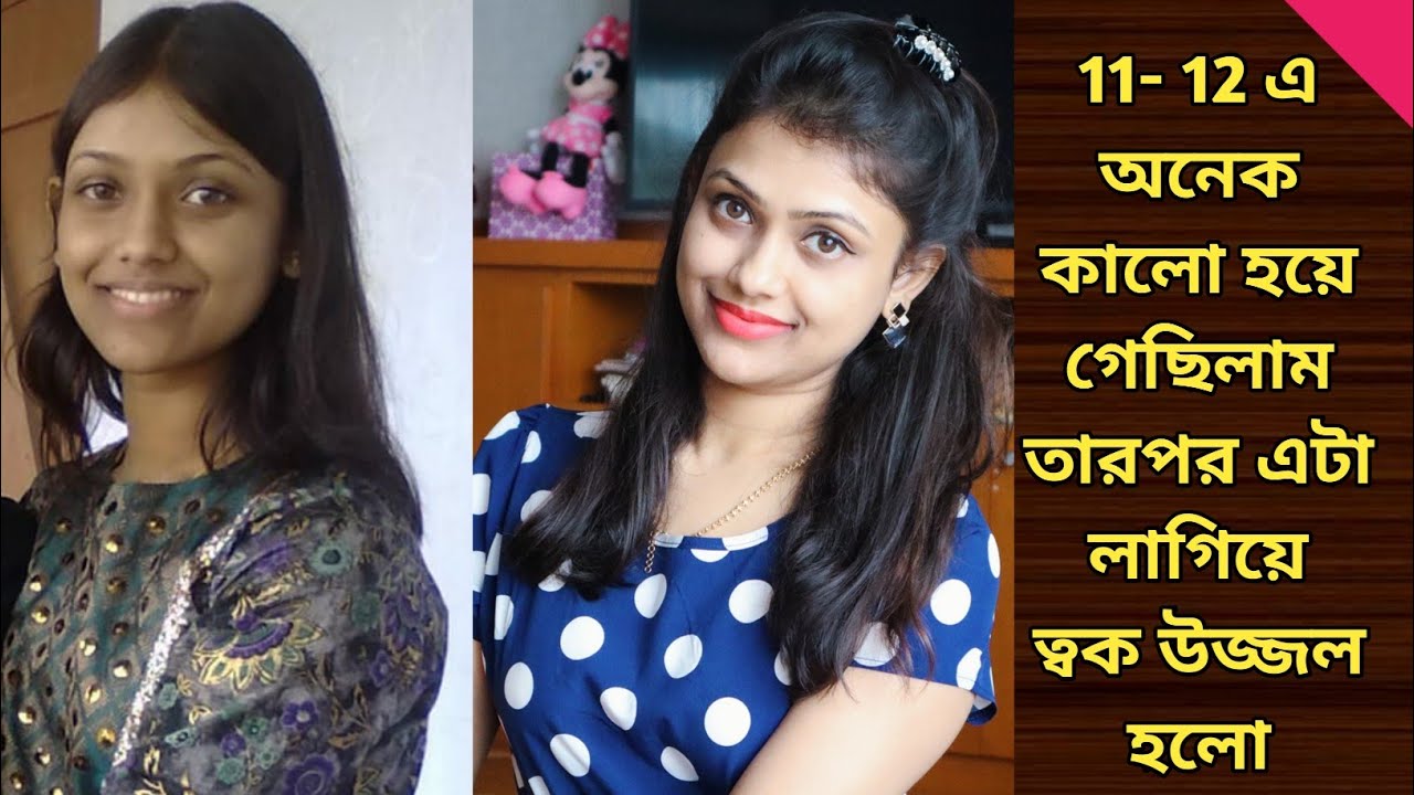 11- 12 এ অনেক কালো হয়ে গেছিলাম | How To Make Skin Glow | Skin Fairness Face Pack