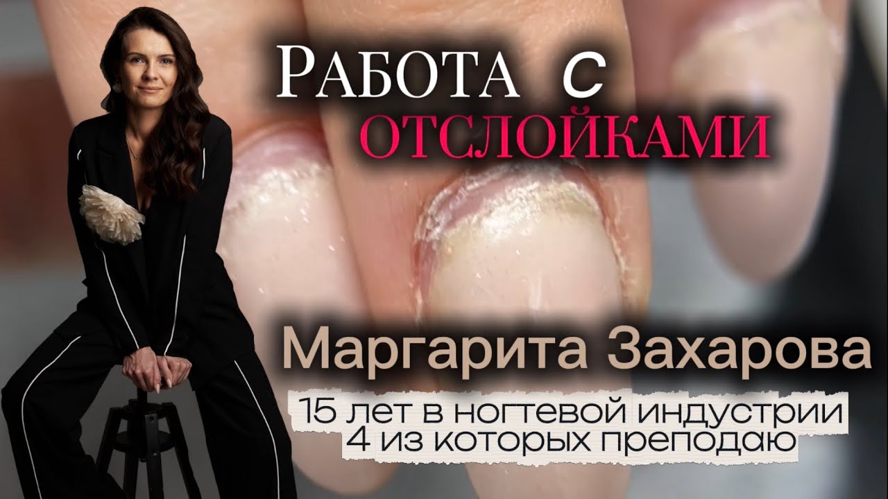 Как работать с отслойками? Подсвечиваю все важные нюансы! 
