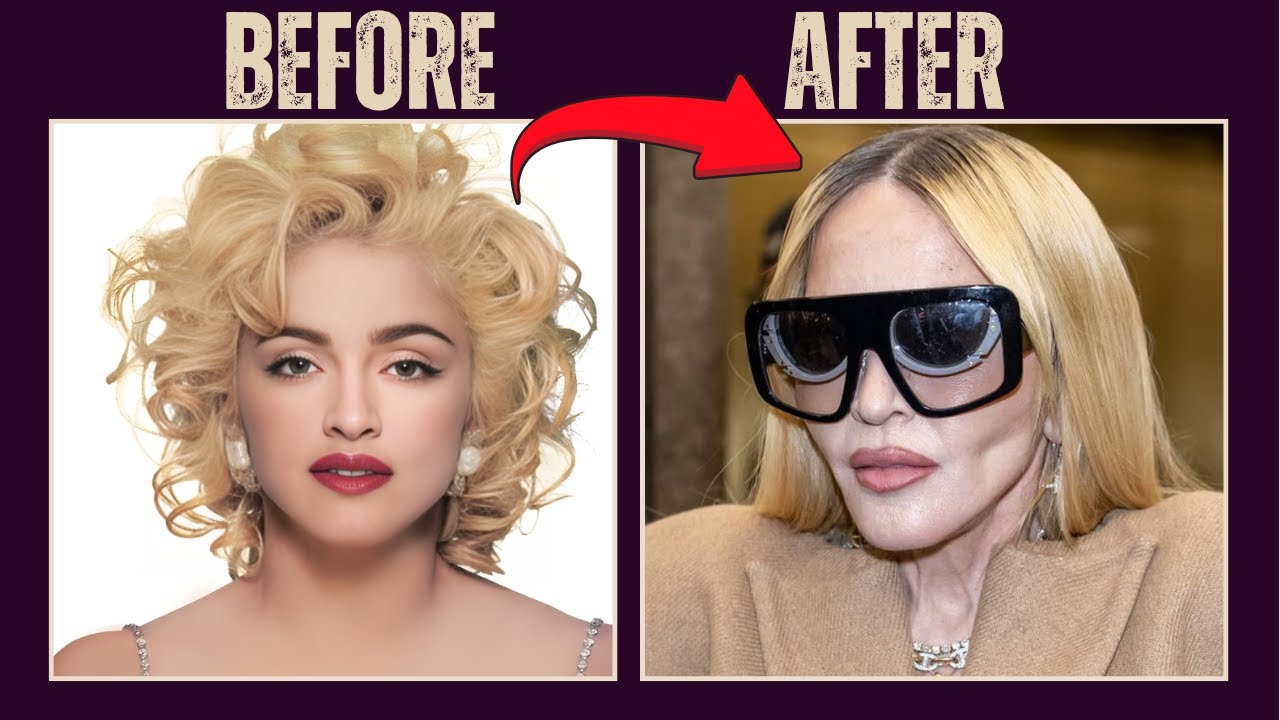 MILLIONS Spent to Look Like THIS 😱 25 Celeb Plastic Surgery Regrets