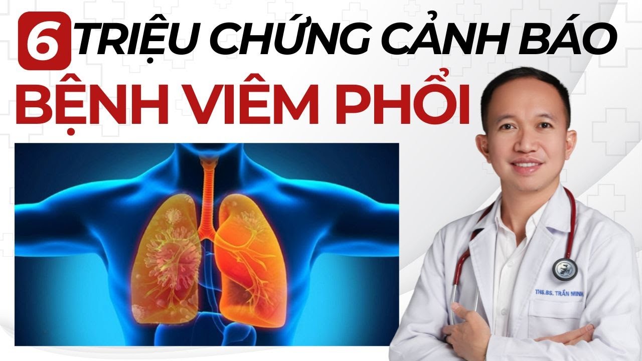 6 Triệu Chứng Cảnh B&aacute;o Bệnh Vi&ecirc;m Phổi m&agrave; mọi người rất hay bỏ qua | B&aacute;c Sĩ Trần Minh