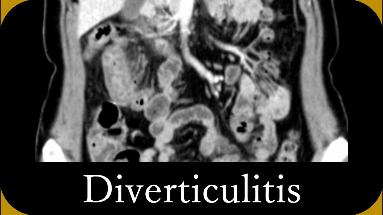 Imaging diagnosis of 