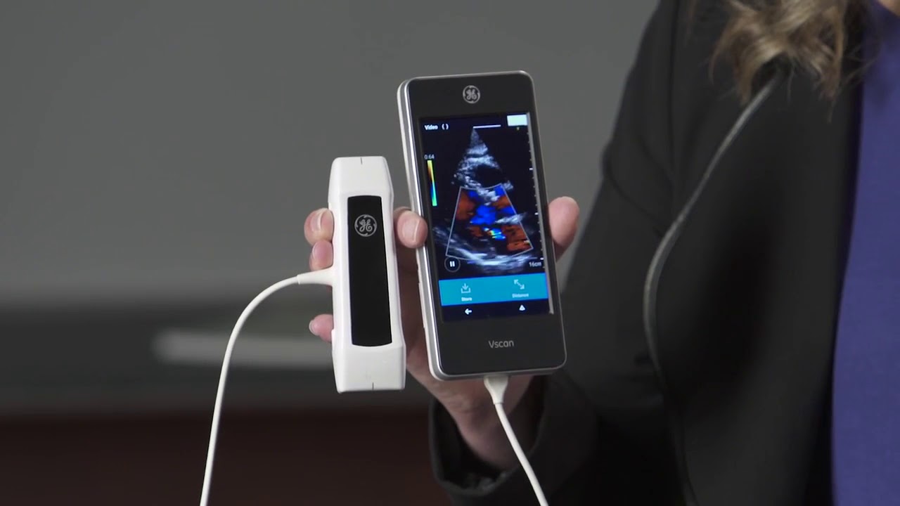 GE Vscan Extend - Introduzione (eng) da CFS Prodotti Medicali