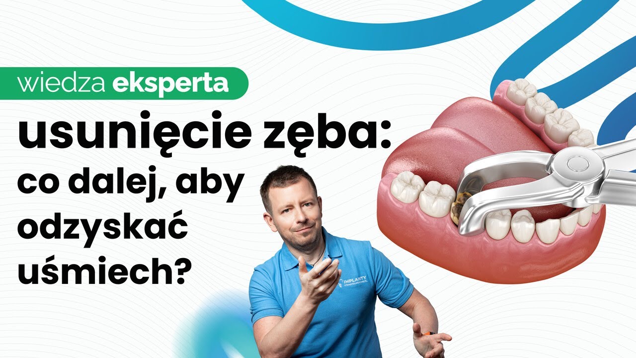 IMPLANTACJA NATYCHMIASTOWA ✨BEZBOLESNE USUWANIE ZĘBÓW I WSZCZEPIENIE IMPLANTU PO EKSTRAKCJI
