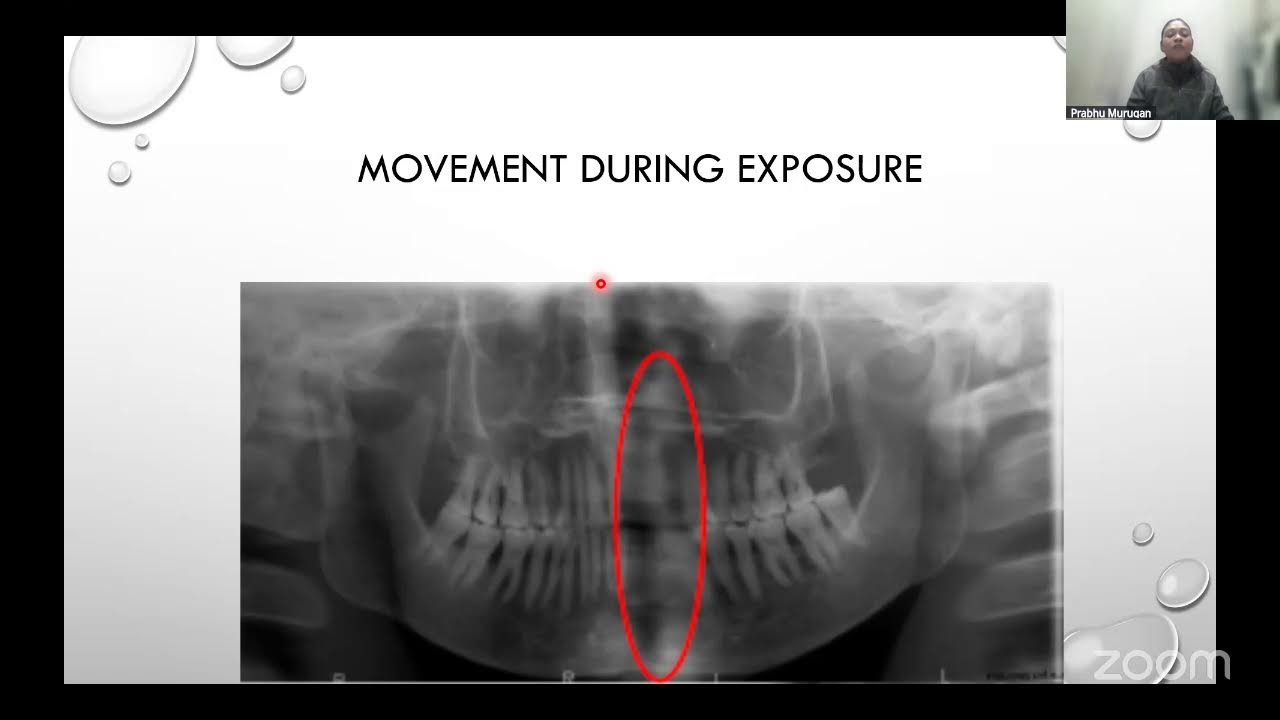 Oral Radiology : High Yield Theory & MCQ Discussion