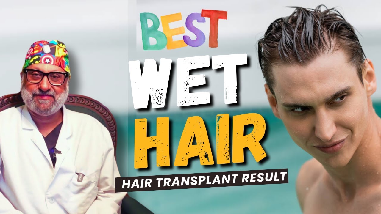 Best Hair Transplant in India | Best Hair Transplant Results with Wet Hair