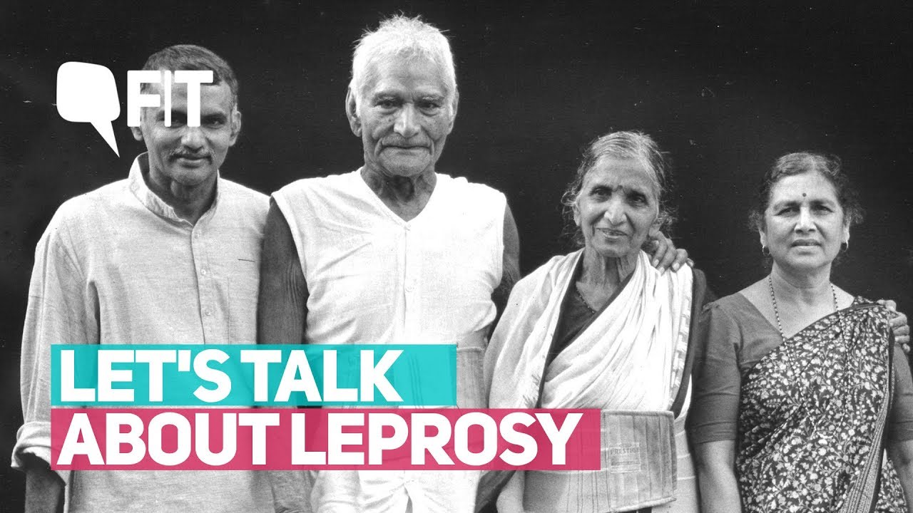 The Stigma Surrounding Leprosy | Quint Fit