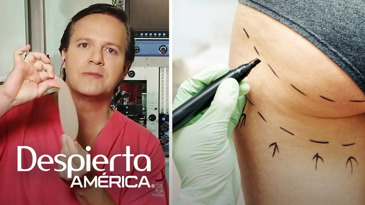 Mitos y realidades de los implantes de glúteo