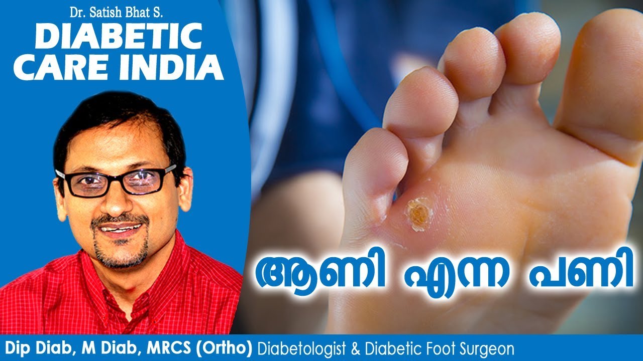 ആണി എന്ന പണി | Diabetic Care India| Malayalam Health Tips