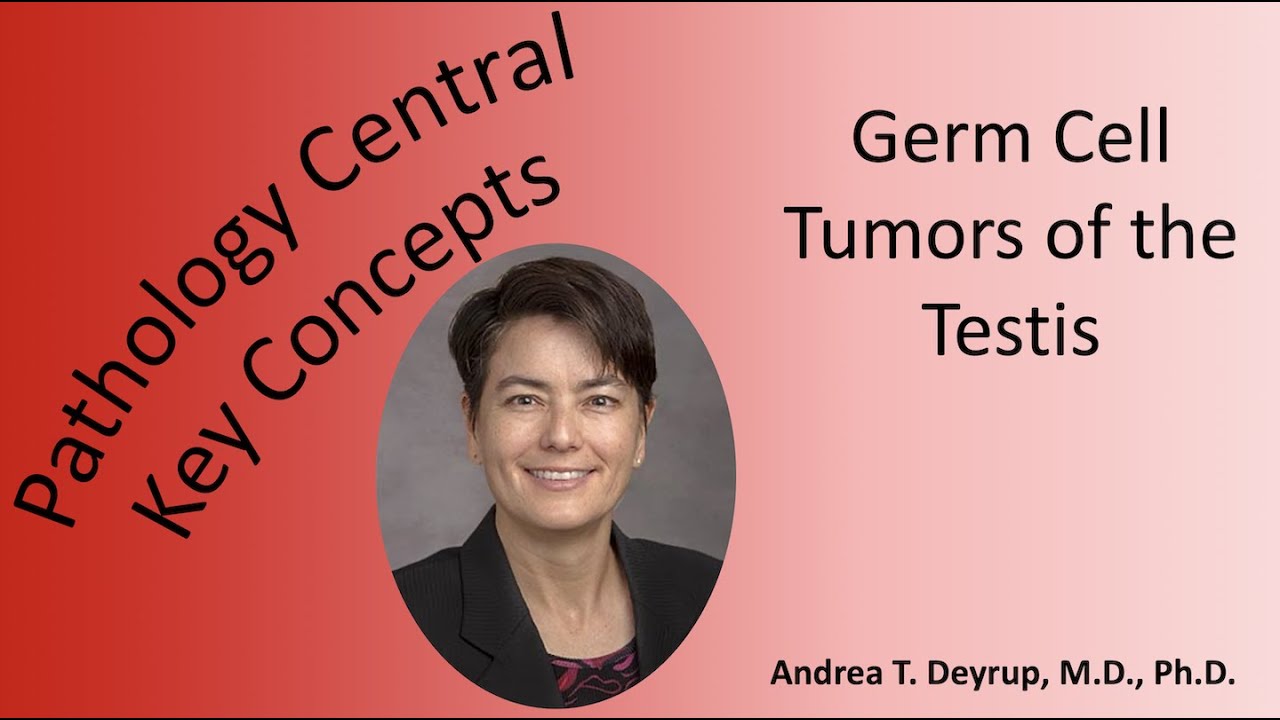Medical School Pathology: Pathophysiology of Germ Cell Tumors of the Testis