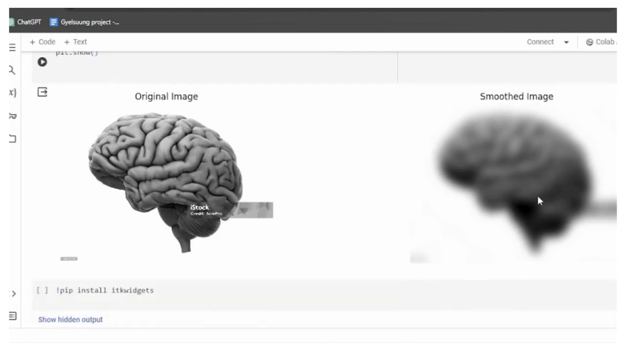Medical Image Processing with ITK library