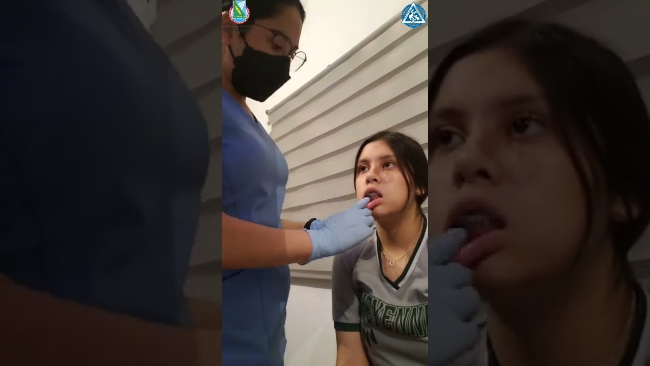 PATOLOGÍA BUCAL: Exploración de la mucosa bucal