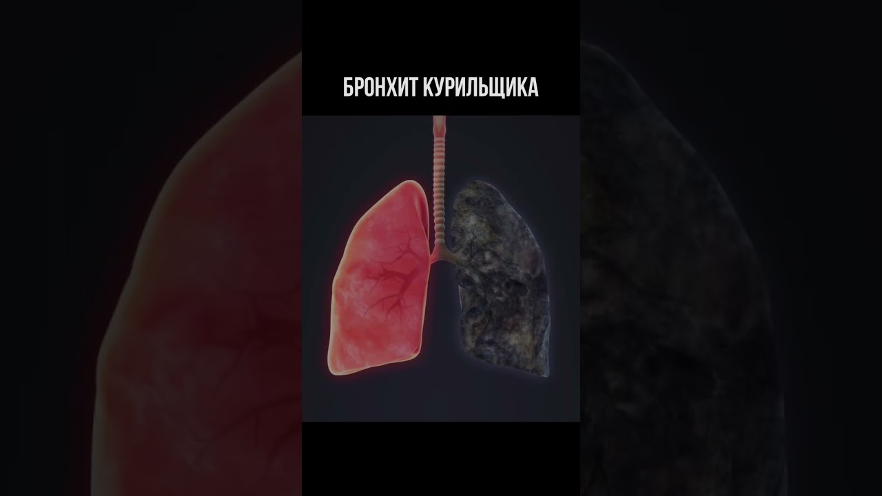 #астма #врач #доктор #медицина