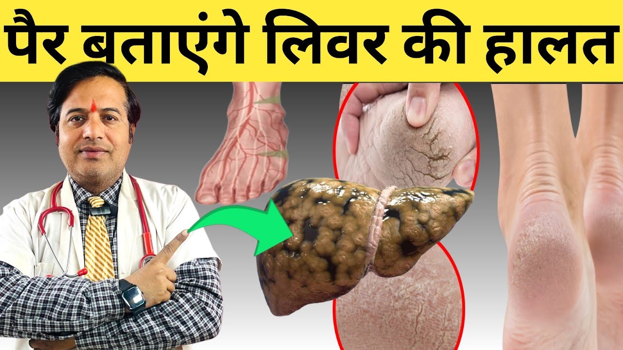 पैर बताएंगे लिवर की हालत || पैरों में ये 5 लक्षण लिवर खराब होने की चेतावनी है || Liver Kharab Hone k