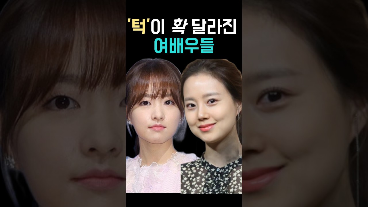 턱이 확 달라진 여배우들, 턱모양도 유행 탐