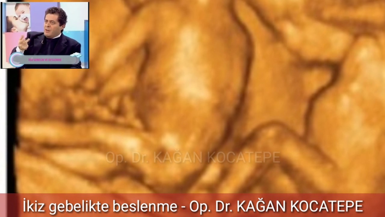 İKİZ GEBELİKTE BESLENME VE İSTİRAHATTE NELERE DİKKAT EDİLMELİ, ÖZELLİKLE HANGİ BESİNLER TÜKETİLMELİ?