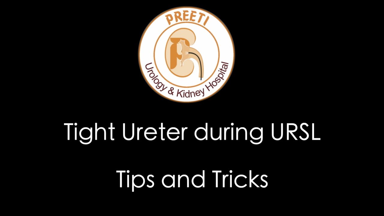 Tight ureter during URSL - Tips and tricks