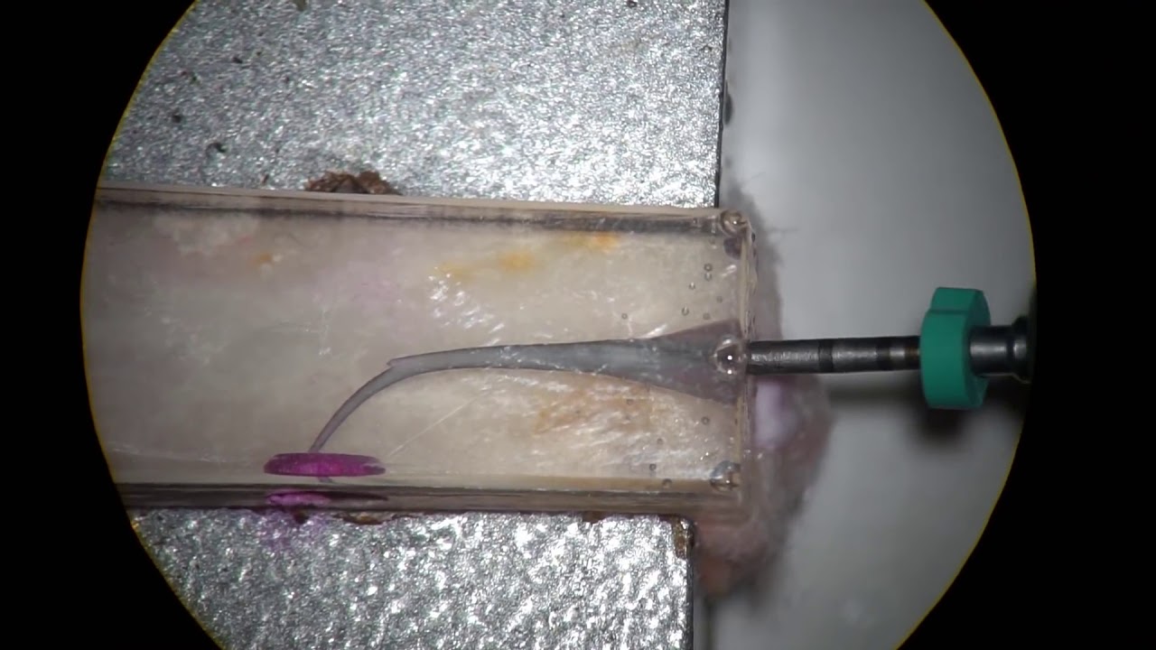 Eighteeth motor to bypass a ledge by Dr.Yoshi Terauchi