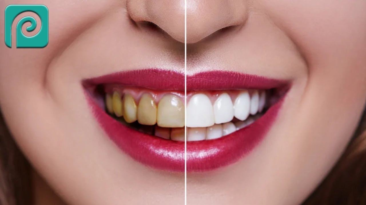 TRANSFORME SEU SORRISO! APRENDA A CLAREAR DENTES NO PHOTOPEA AGORA!