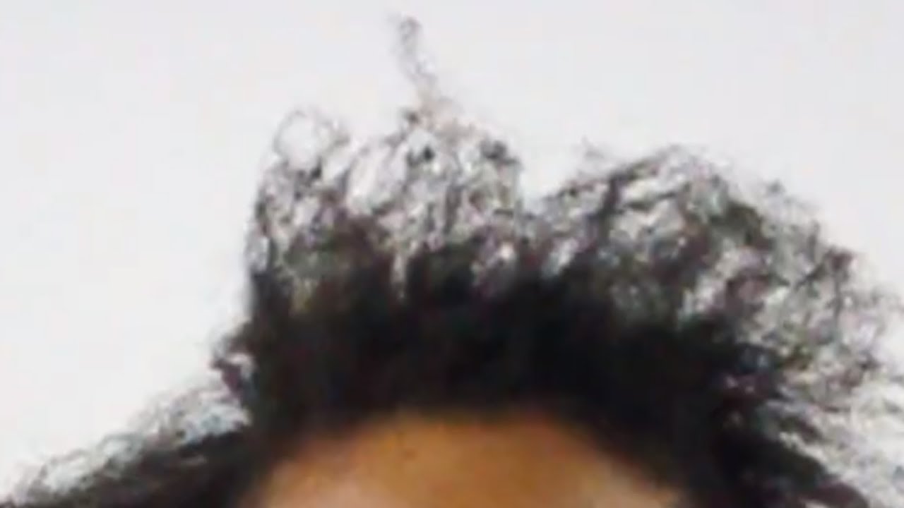 Thinning Hair Causes/Remedies For African American Women Hair