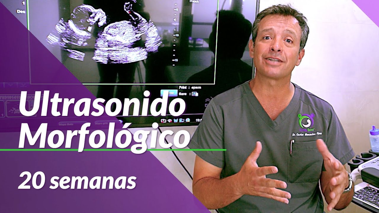 Ultrasonido morfológico [20 semanas de embarazo]
