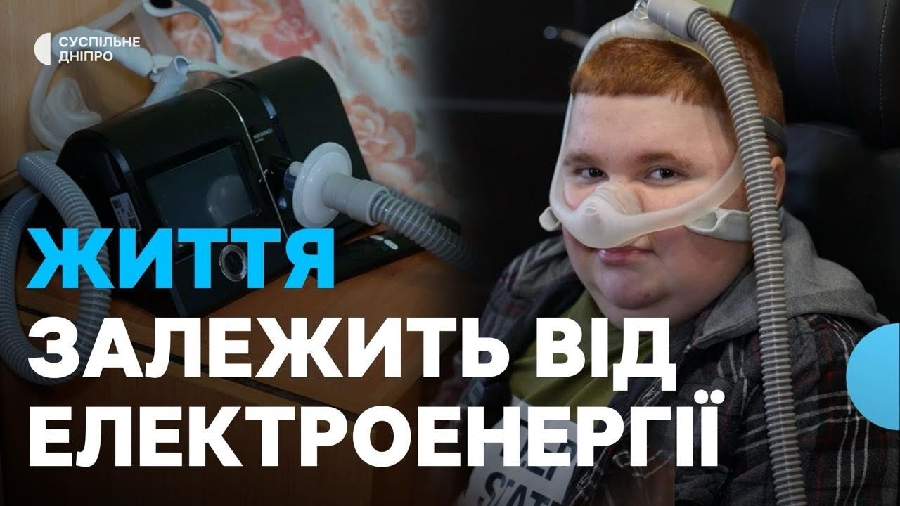 Життя на електроенергії: як діти з інвалідністю у Дніпрі виживають під час частих відключень світла