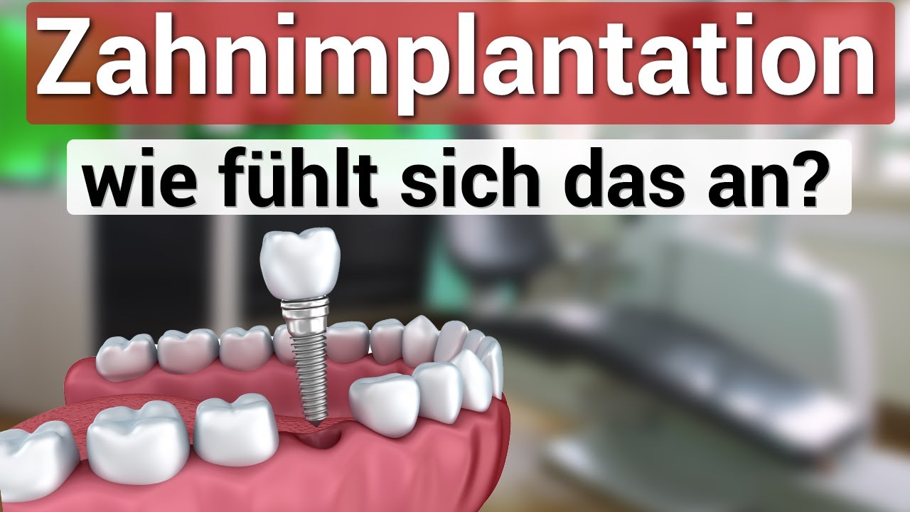 Wie fühlt es sich an ein Implantat zu bekommen?