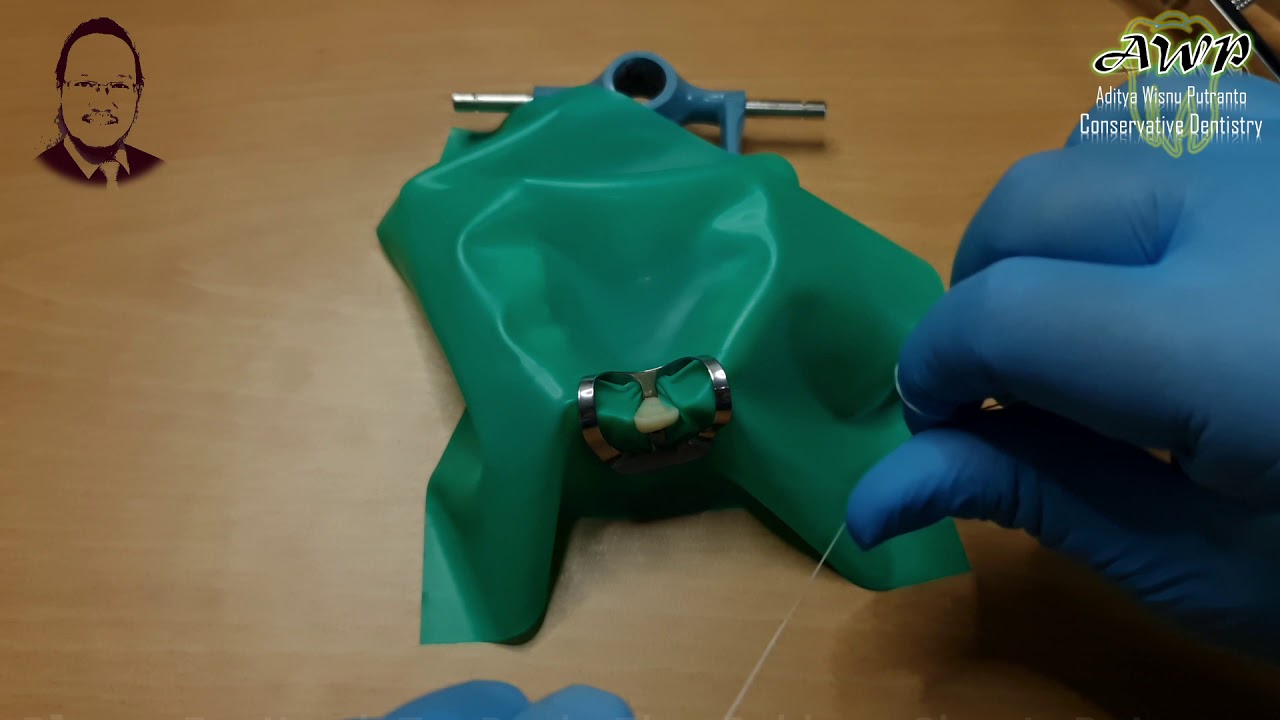 Rubberdam Workflow on Anterior Teeth - Single Isolation Technique