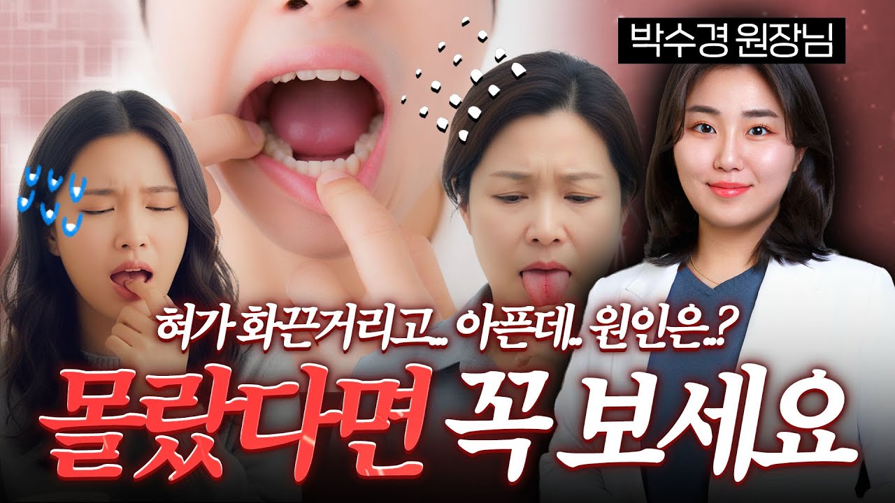 혀가 화끈거리고 따가운 이유, 병원에서 몰랐던 진짜 원인 공개! (구강작열감증후군), 본향한의원