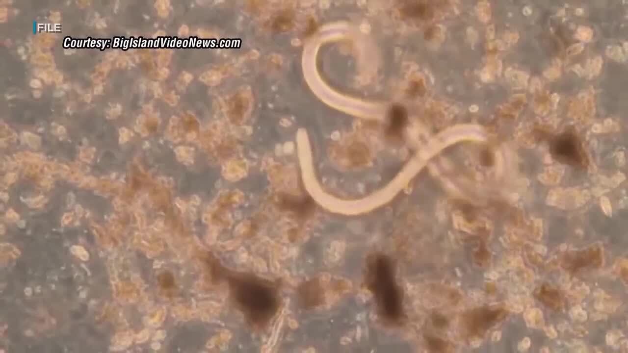 New case of rat lungworm disease confirmed on Kauai