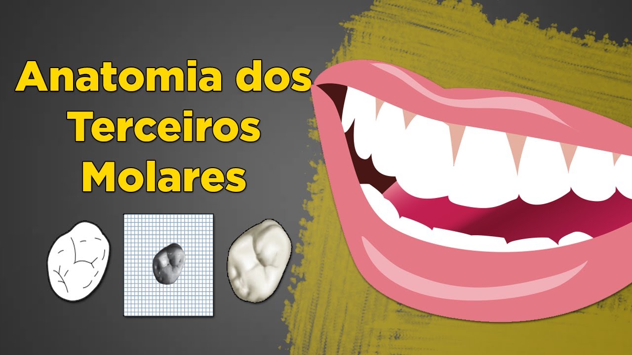 Anatomia dos Terceiros Molares - Resumo de Anatomia Dental – Dente 18, 28, 38 e 48