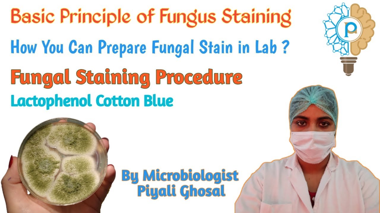 Fungus Staining Procedure | Fungal Staining by Lactophenol Cotton Blue