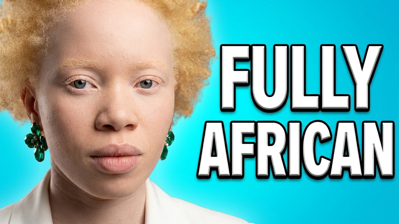 The Beautiful WHITE  'BLACK' Africans.