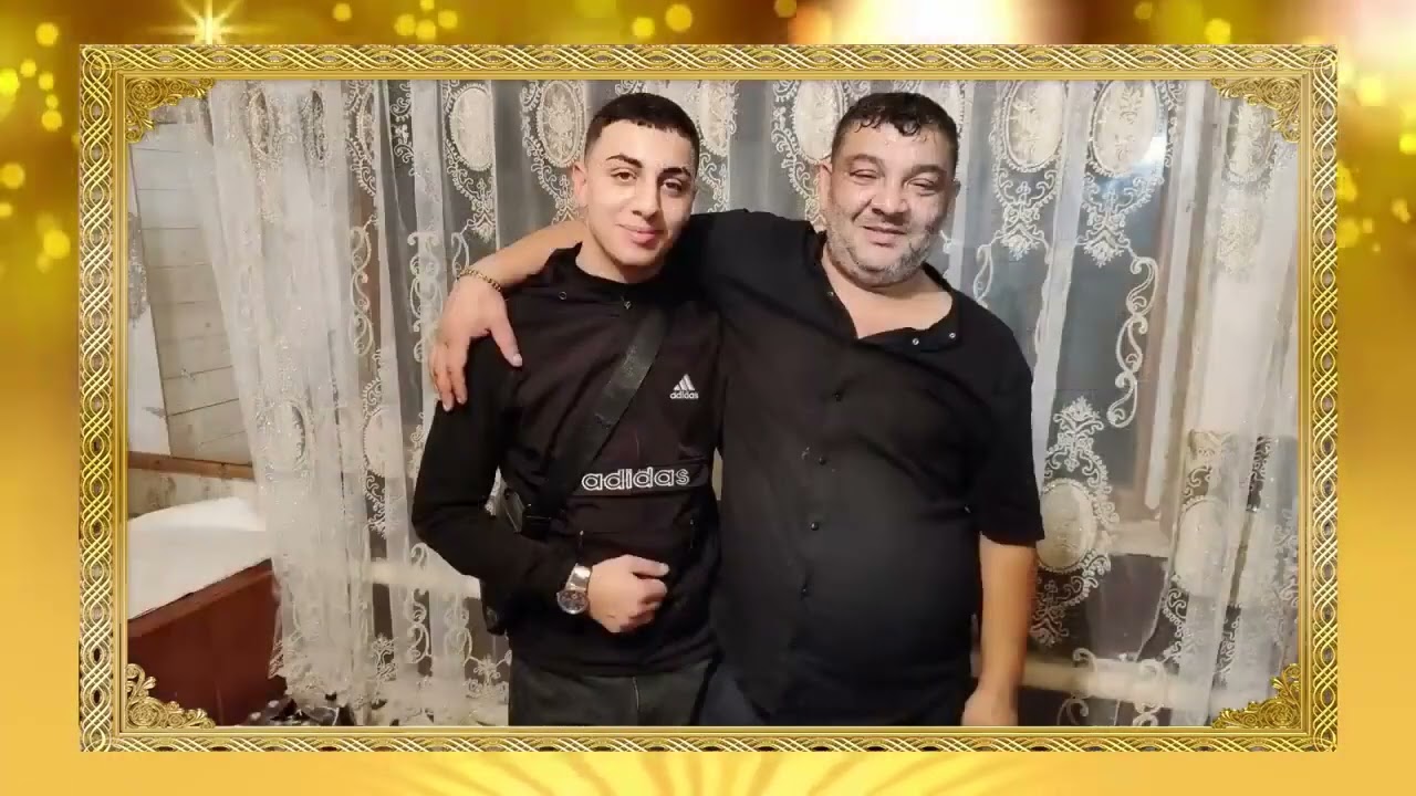 Meşhur Şaşı D&uuml;ğ&uuml;n&uuml;