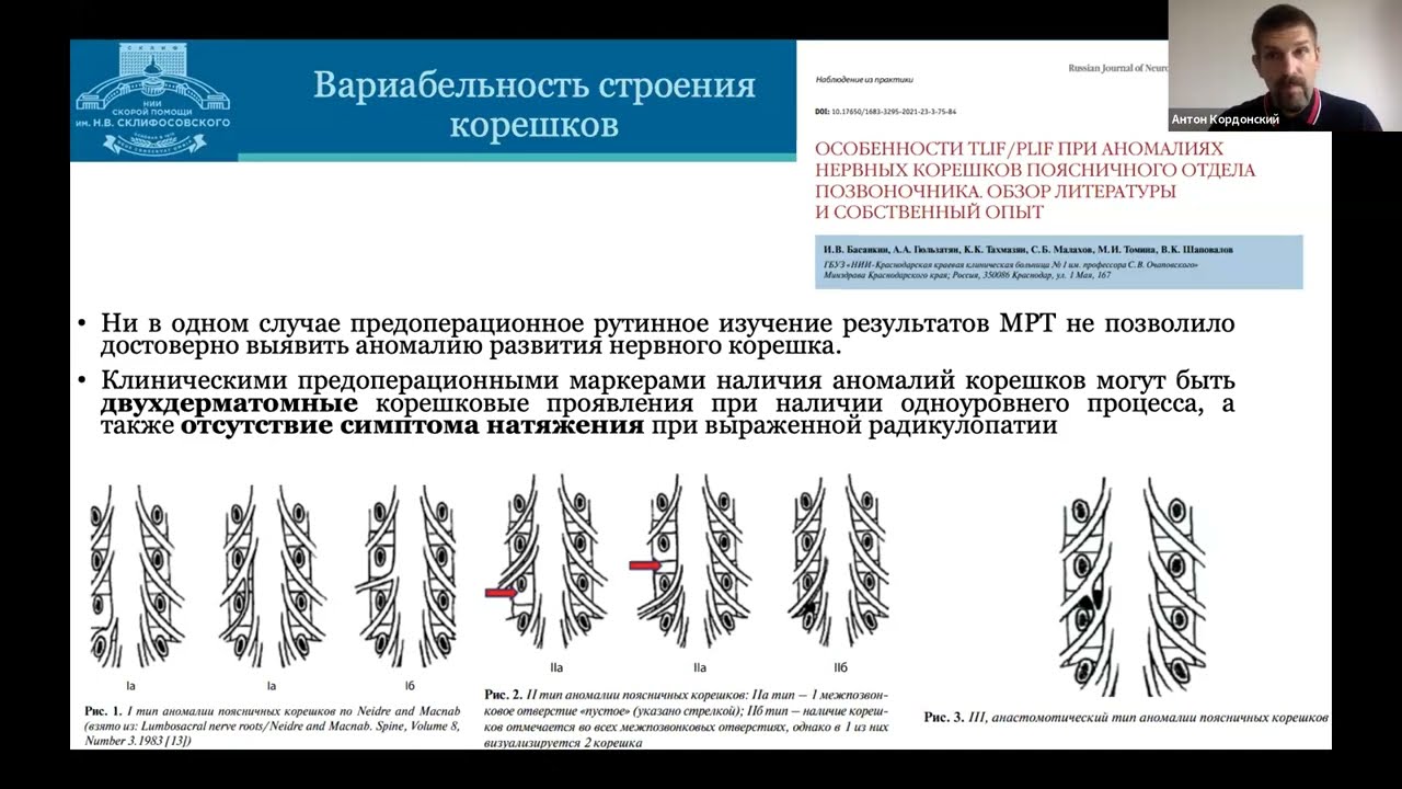 Миография при дегенеративных заболеваниях позвоночника. Круглый стол. Лекции и дискуссия