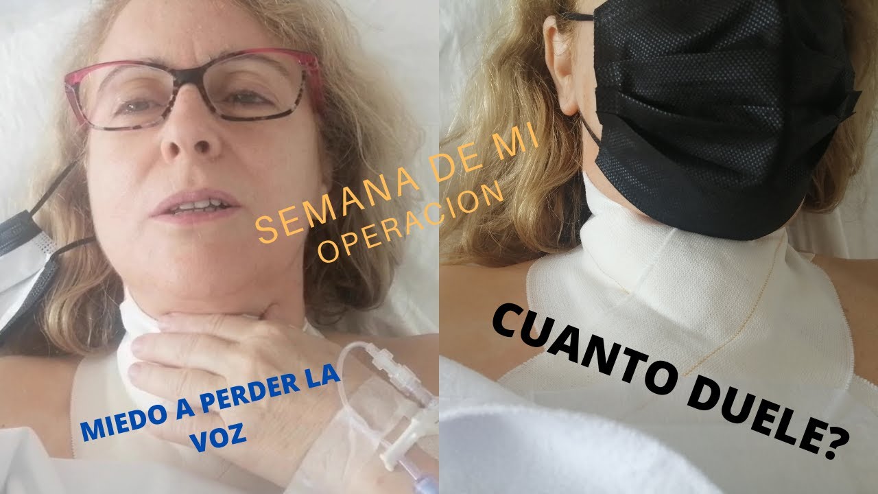SEMANA DE MI  INTERVENCION DE PARATIROIDES