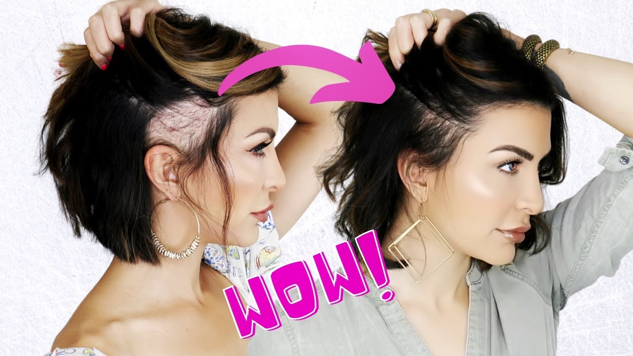 Hair Transplant Results After 6 Months | Answering YOUR Burning Questions!