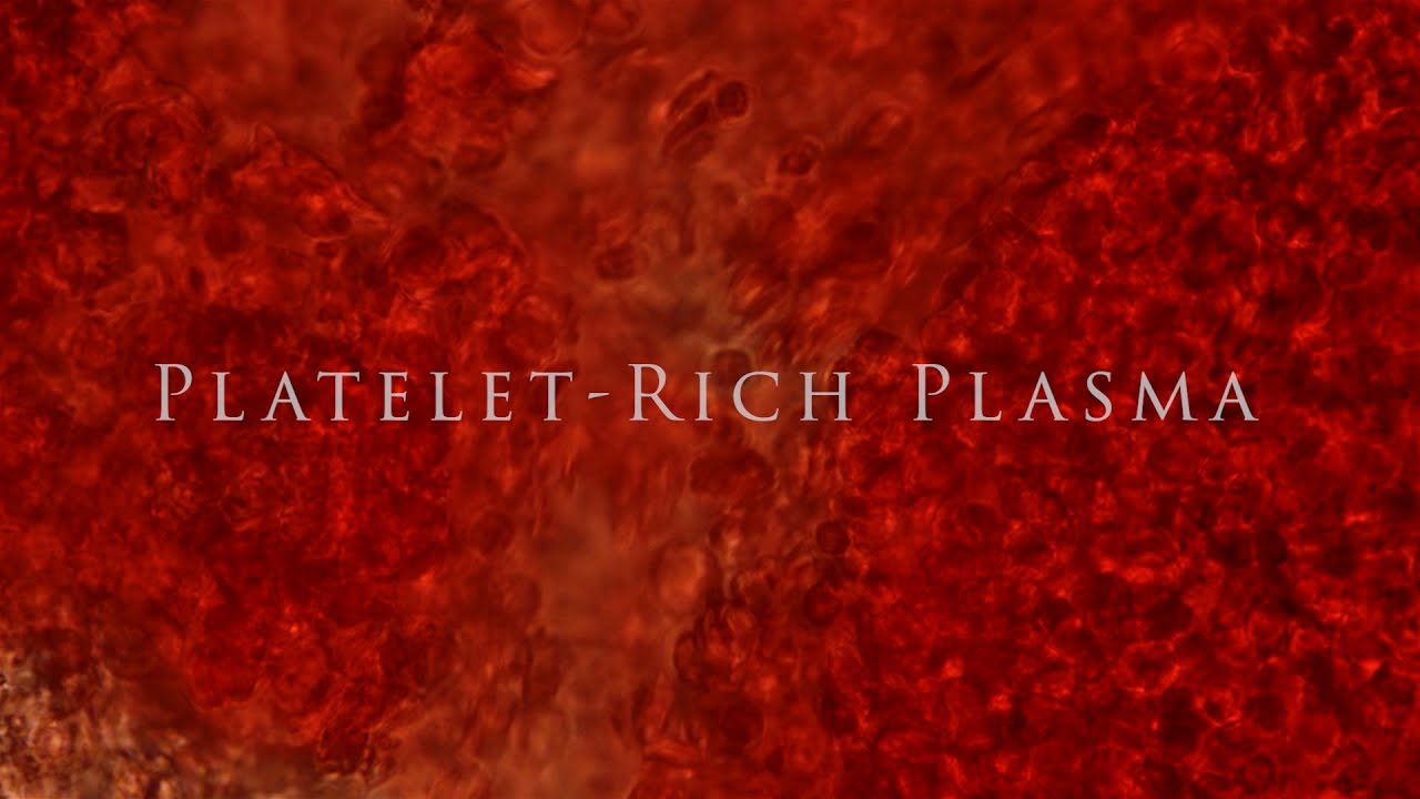 Platelet-Rich Plasma | Dr. Heil